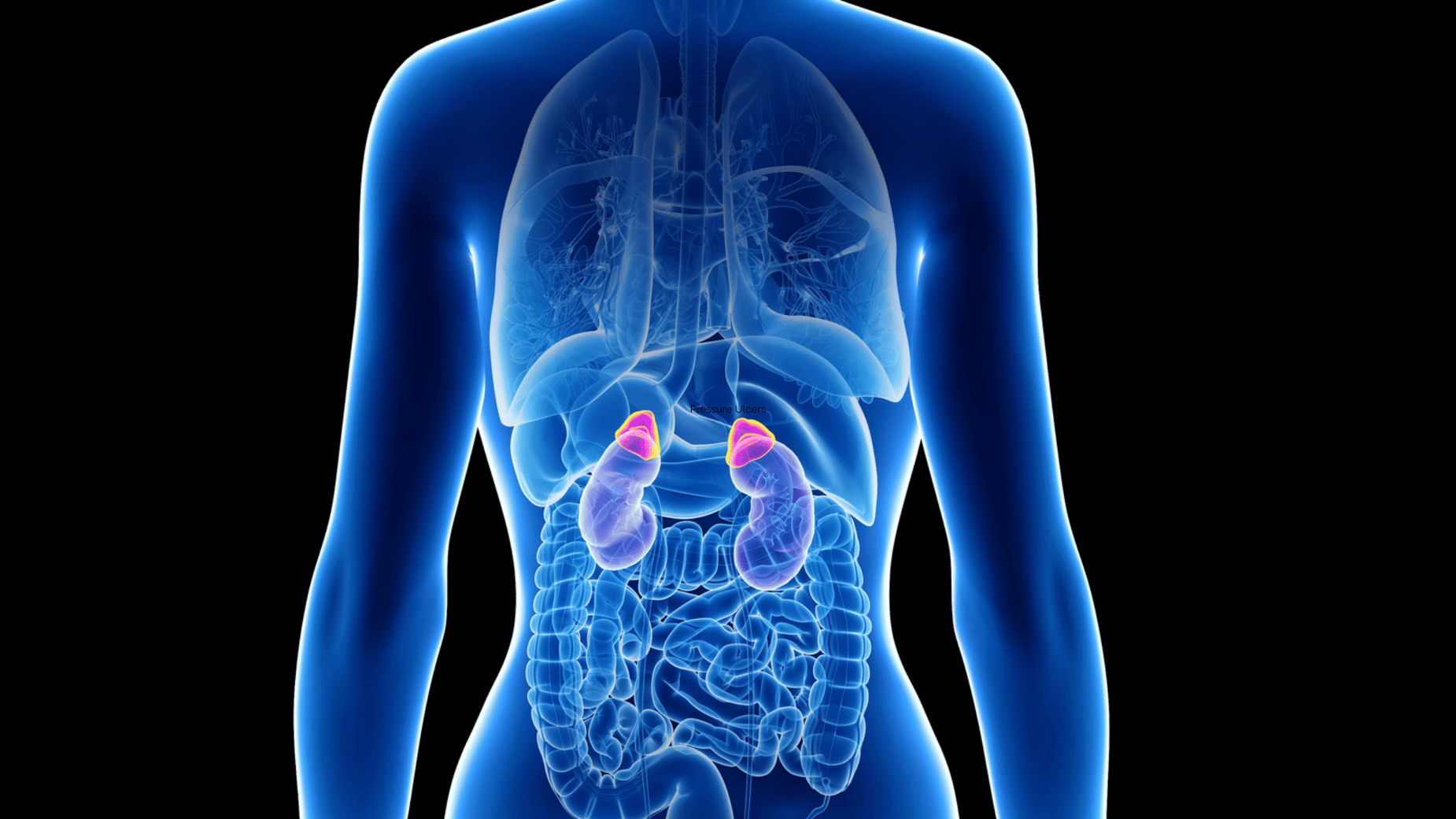 Cushings Syndrome NCLEX Review for Nursing Students + Free Download